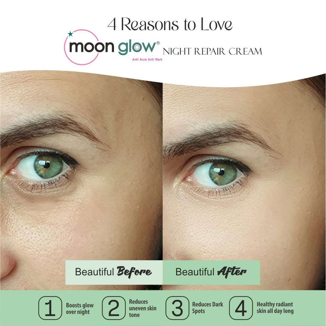 Moon Glow Cream, Pearl Face Wash and Soap for Acne, Pimples, Black Spots, Dark Circles, Stretch Marks, Anti-Aging and Fairness (1 Cream + 1 Pearl Face Wash +1 Soap)